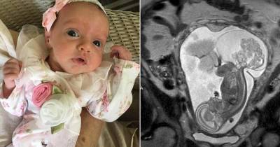 This Baby Was Born Twice For An Operation And Then Put Back In To Be Born Again