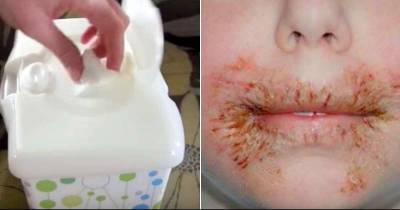 Doctor's Warn To Never Clean Your Child With Baby Wipes No Matter What