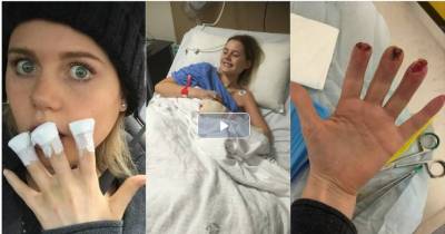 A Young Woman Loses Her Fingertips And Here Is The Shocking Reason Why