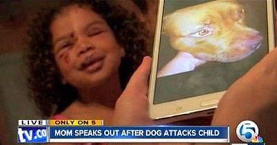 When The Neighbor&rsquo;s Dog Attacked This Little Girl, Her Pit Bull Came To The Rescue