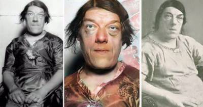 Mary Ann Bevan - The World's Ugliest Woman