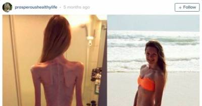 This Young Woman Was Rescued Just Before Dying Of Starvation.