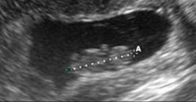10-Year-Old Goes To The Hospital For Ultra Sound, Leaves Doctors Scratching Their Heads