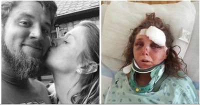 Girl Who Appeared To Have A Perfect life Has Her Tongue Ripped Out By Boyfriend