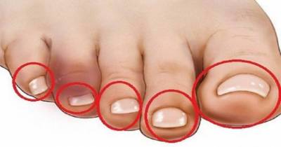 Touch The End Of Your Toes To Know If You Have A Heart Problem Or Not