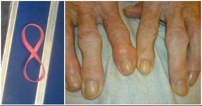 Easy Hand Exercises To Keep Pain And Stiffness Away