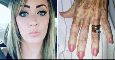 Woman Works In Nursing Home, Snaps Picture Of Resident&rsquo;s Hand That&rsquo;s Going Viral