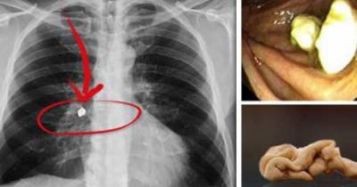 This Is What Actually Happens When You Swallow Chewing Gum