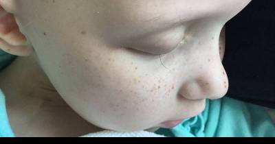 Dad Shares The Heartbreaking Results Of Chemo: 'One' Is All That&rsquo;s Left Of Daughter&rsquo;s &lsquo;Beautiful Lashes'