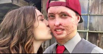 After Surviving A Terrible Accident This Former Firefighter Found His True Love