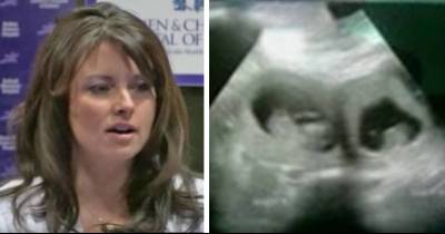 Mom With Two Uteruses Goes In For Ultrasound, Then Doctor Spots A Baby In Each