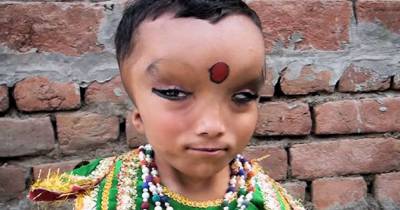 Boy Born With Unknown Condition Is Worshipped As A God
