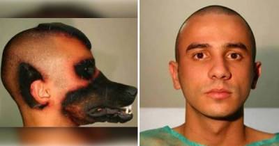Extreme Surgeries That Crazy People Paid Huge Cash For