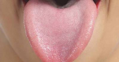 Girl Uses Her 4.48 Inch Tongue To Touch Her Ear And Her Elbow