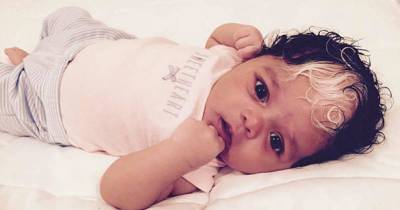 Little Girl Was Born With An Unusally Beautiful Genetic Defect