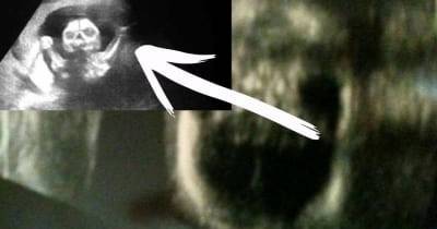 These Parents Shared Their Ultrasound Pictures And You'll Be Terrified By What You See