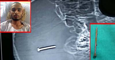 How This Carpenter Survived This Freak Accident Has The World Shocked