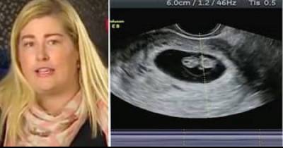 Pregnant Woman Goes For Ultrasound When Doctor Sees Another Baby Who Wasn&rsquo;t There 10 Days Ago