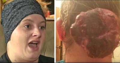 She Goes To 4 Different Doctors, But None Of Them Realize &lsquo;Cyst&rsquo; Is A Tumor