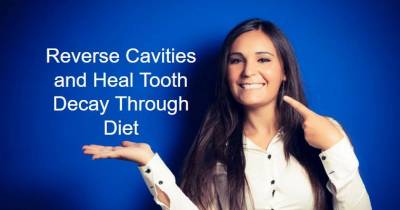 Reverse Cavities Naturally & Heal Tooth Decay With This Simple Diet