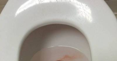 If You Thought Your Day At Work Sucked, Imagine Finding These Horrible Things On The Job
