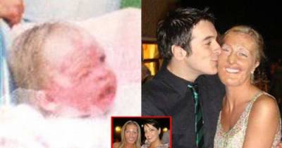 At The Age Of 2, She Had Burns Over 90% Of Her Body - See How She&rsquo;s Coping Today At Age 30