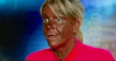 Mom Of 3 Was Famous For Tanning Herself To A Crisp. 4 Years Later, She Looks So Different