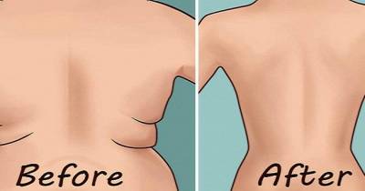 This Magical Remedy Will Help You To Get The Perfect Waist!