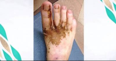 She Shows The Doctor Her Foot, What He Tells Her Is The Last Thing She Was Expecting