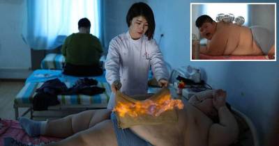 330 Pounds 11-Year-Old Is Set On Fire And Undergoes Cupping Treatment To Lose Weight