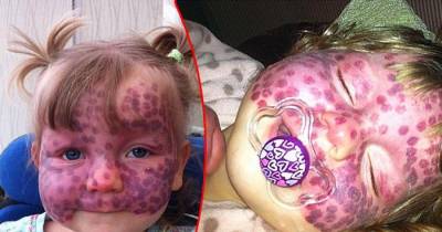 OMG! 5 Shockingly Peculiar Childern Born That You Probably Didn't Know About.