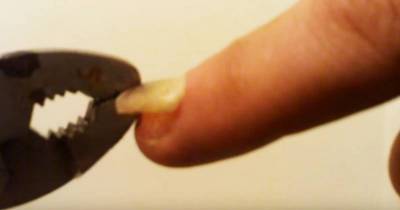 You Ever See Anyone Rip Their Fingernails Off With Pliers Before?