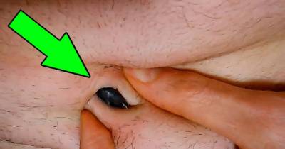These Are The Dirtiest Parts Of Your Body