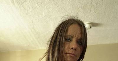 Woman With Almost 6,000 Tumors Just Wants To Be Loved And Accepted For Who She Is