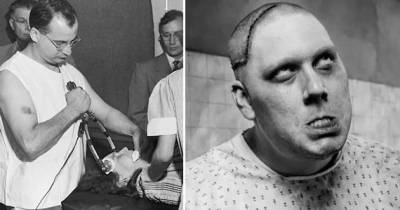 Terrifying Images Of Real Lobotomies