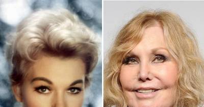 Celebrities Who Ruined Their Career With Plastic Surgery.