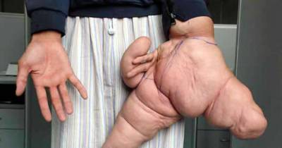 7 Unbelievable Genetic Disorders