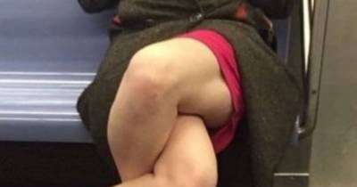 Picture Of A Woman's Double-crossed Legs Is Freaking People Out
