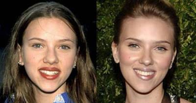 10 Best Plastic Surgery Make-Overs