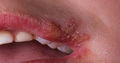 Do You Experience Any of These Symptoms? Here Is What It Means!