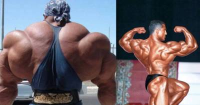 16 Bodybuilders Who Took Lifting Too Far
