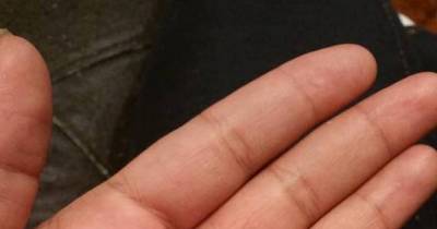 Wife Reveals Why She Refuses To Removed Broken 3rd Wedding Band