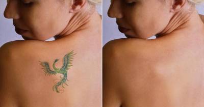 Ever Wondered What Happens To Tattoos When You Remove Them?