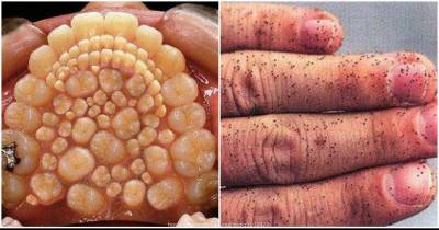 10 Most Disgusting Pictures You Will Ever See On The Internet
