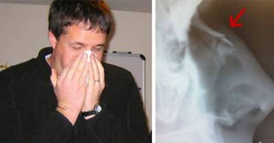 7 Surprising Things You Should Never Do While Battling A Cold