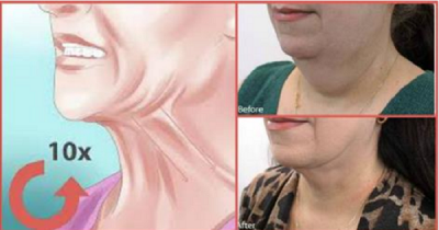 Get Rid Of Double Chin Forever With This Simple Trick, All You Need Is One Ingredient!