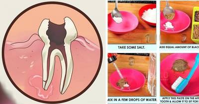 Here's How To Cure Your Toothache In Seconds, You Can Thank Us Later