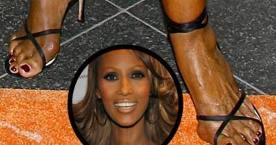 15 Celebrities With Messed Up Feet