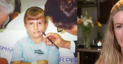 'The Little Girl Who Couldn't Smile' Looks Unrecognizable 20 Years After Surgery Changes Her Face