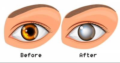 Woman Blinded Because Of Something Most People Do Every Night